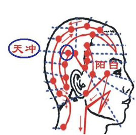 天沖穴→治頭痛、齒痛