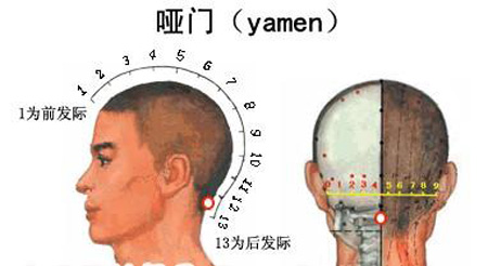 啞門穴→治音啞、頭痛