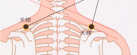 天髎穴→預(yù)防肩關(guān)節(jié)炎