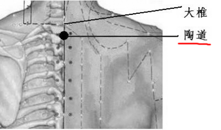 陶道穴→治頭痛項強(qiáng)