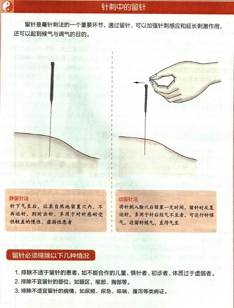 針刺穴位時(shí)有哪些需要注意的？