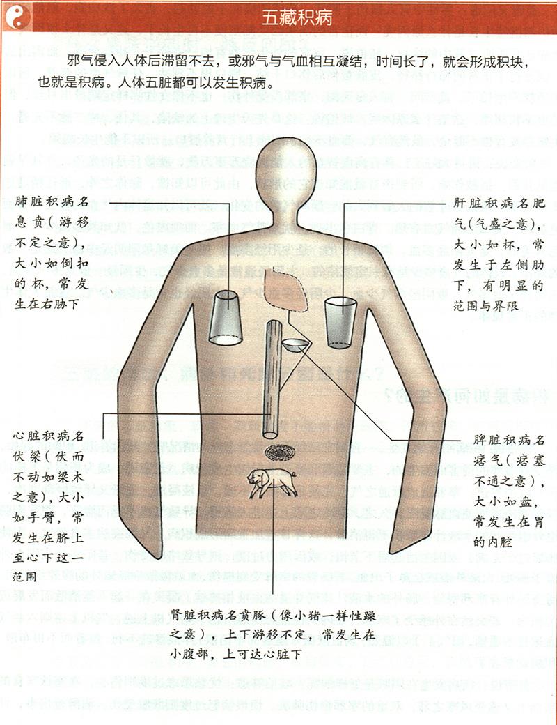 積病是如何產(chǎn)生的？